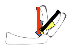 Foto von Dr. Gabl: Skizze einer Verschraubung.